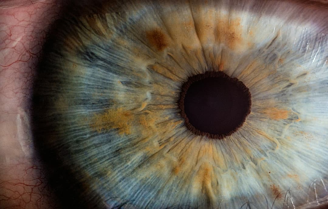 Neurovision Clinic 2